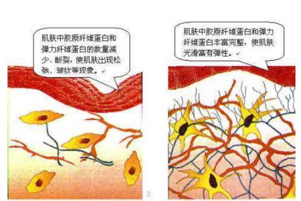 皺紋的出現(xiàn)因素