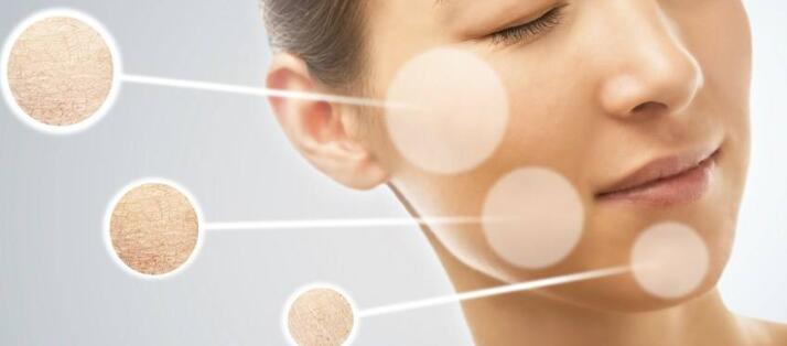 皺紋有哪些種類？