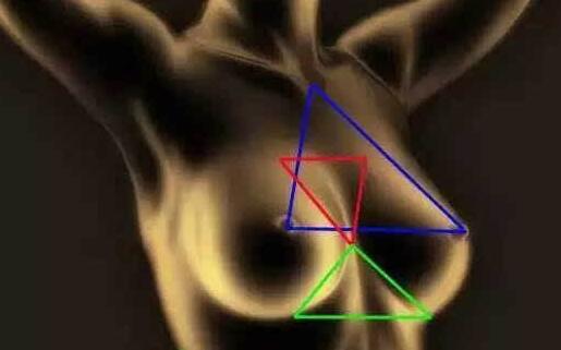 假體隆胸手術中采用哪種手術切口會比較好？