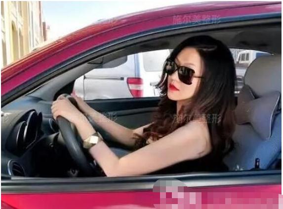 做手臂吸脂術(shù)手術(shù)術(shù)后兩個(gè)月