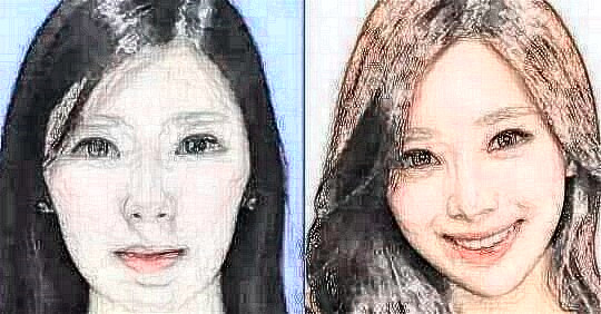 做自體脂肪填充能保持多久？