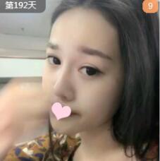 韓式三點重瞼術(shù)后注意和恢復時間?