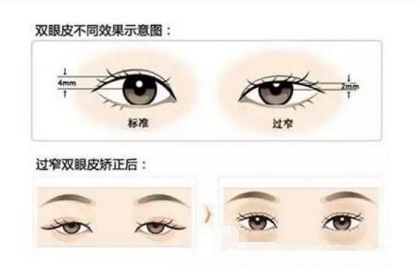 張鋒醫(yī)生擅長項(xiàng)目