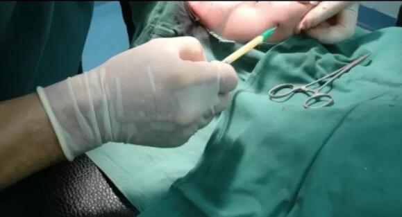 張鋒醫(yī)生簡介