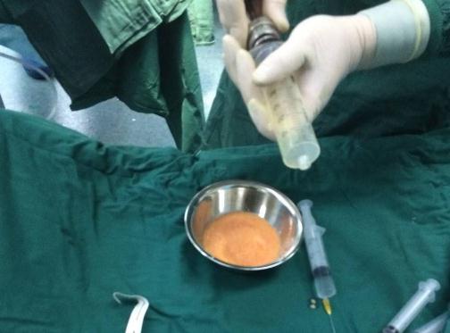 段小兵醫(yī)生手術(shù)風(fēng)格