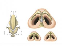 鼻頭縮小手術(shù)價格費(fèi)用，醫(yī)院收費(fèi)詳情！