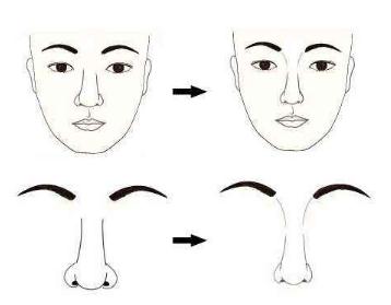 什么是鼻子縮小術？