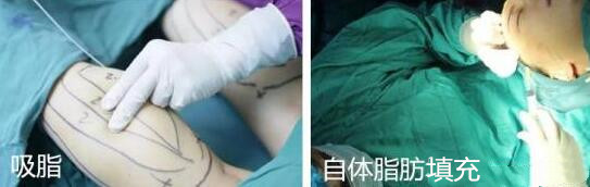 段小兵醫(yī)生手術(shù)風(fēng)格