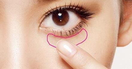 眼袋抽脂術(shù)的優(yōu)勢(shì)