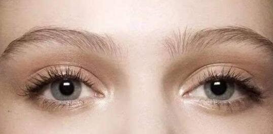 可以改良很多眼部問題