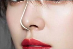 做線-雕隆鼻大概是多少錢？收費(fèi)標(biāo)準(zhǔn)是怎樣的？