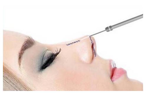 什么是************？