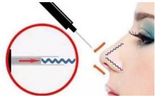 什么是************？