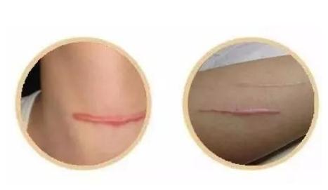 調(diào)節(jié)方法都有哪些?