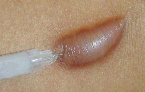 調(diào)節(jié)方法都有哪些?