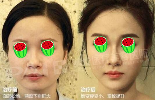 深圳鵬愛整形美容醫(yī)院理念