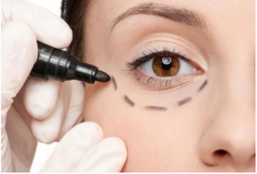 眼袋手術(shù)內(nèi)切法、外切法、眶隔脂肪釋放的價(jià)位