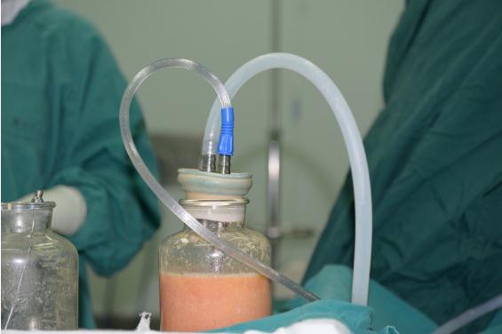 腰腹環(huán)吸果