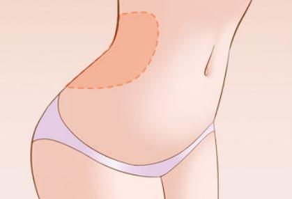 韓國做腰腹環(huán)吸包含哪些部位？是怎么收費(fèi)的？