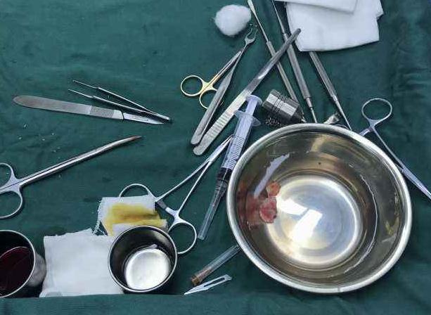 耳軟骨隆鼻尖手術(shù)，時間久了會被吸收嗎？