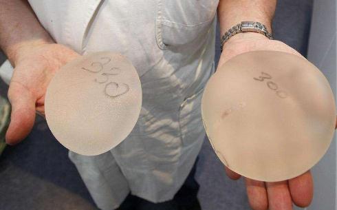 隆胸手術(shù)的假體可以終生不換取嗎？