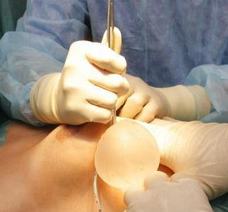 隆胸手術(shù)的假體可以終生不換取嗎？