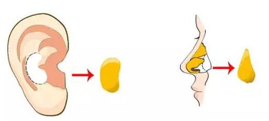 做的耳軟骨墊鼻尖萬(wàn)一被撞歪了可以修復(fù)嗎?怎么修復(fù)？