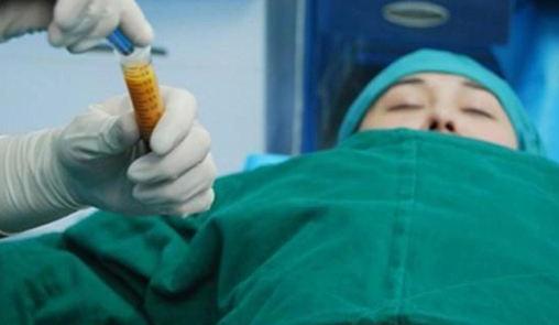 在吸脂豐胸術(shù)前，你需要要了解這些事實！