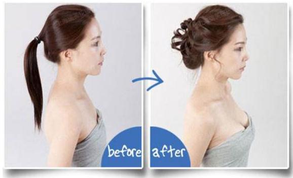 假體隆胸10個(gè)人有9個(gè)做完后悔？后遺癥這么恐怖嗎？