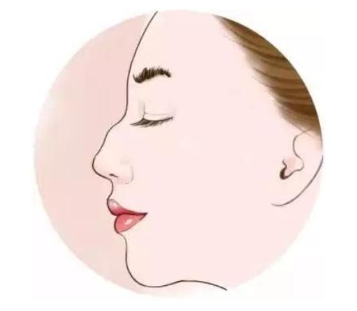 盡管駝峰鼻矯正不是什么大手術(shù)，但是還是得說一說后遺癥問題！