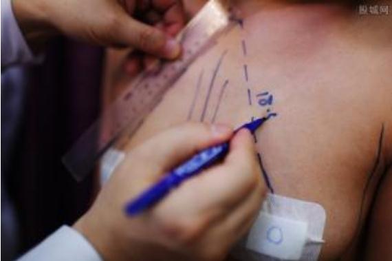 隆胸假體的尺寸應(yīng)該怎樣選擇呢？挑選適合自己的