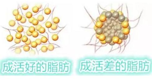 做完自體脂肪填充后沒有果，做二填的果怎么樣？