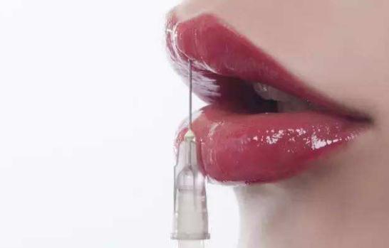 玻尿酸豐唇后多久能接吻？打開kiss的正確方式！