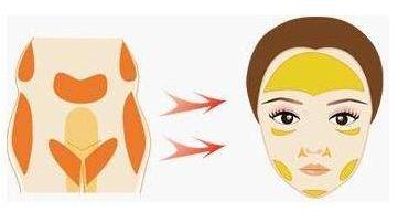 面部脂肪填充十年后是什么樣子？臉會(huì)塌陷嗎？