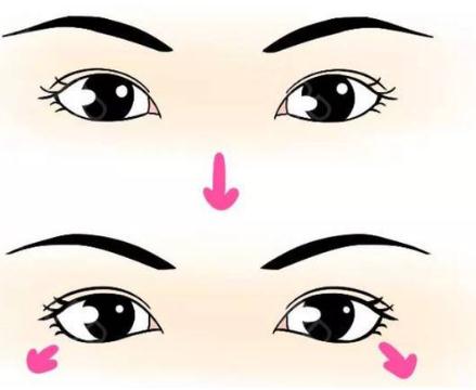 眼瞼下至多久恢復(fù)自然?
