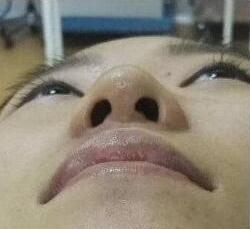 做************一般多少錢？