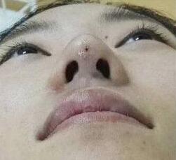 做************一般多少錢？