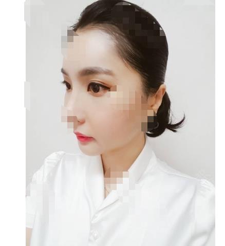 術(shù)后注意事項(xiàng)