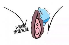 深圳陰唇漂紅多少錢？深圳哪家醫(yī)院技術(shù)好？