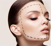 面部脂肪填充凹陷了怎么辦？怎么修復？