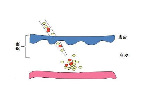 植發(fā)醫(yī)院