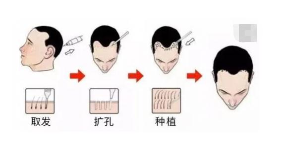 新發(fā)現(xiàn)植發(fā)連鎖機(jī)構(gòu)