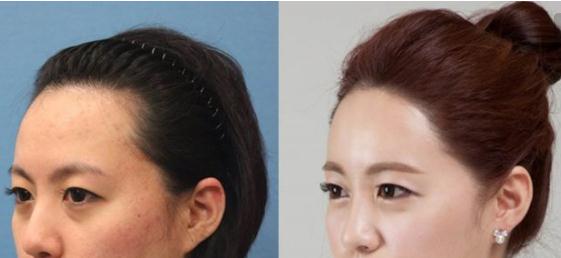 補(bǔ)發(fā)的好處