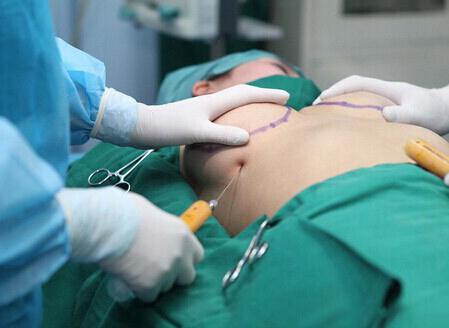 隆胸失敗修復的原則是什么?