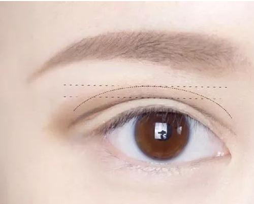 雙眼皮的寬度跟如何選擇？