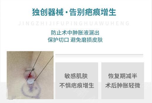 陳江庭醫(yī)生吸脂的獨特技術(shù)