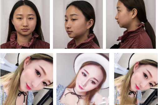 上海華美眼部綜合好不好？