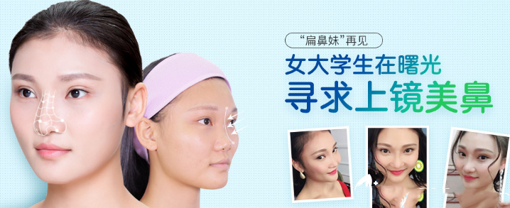 蔣思軍鼻部手術(shù)隆鼻案例對比圖：