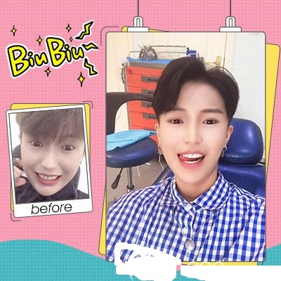 深圳美萊口腔醫(yī)院隱形托槽牙齒矯正案例