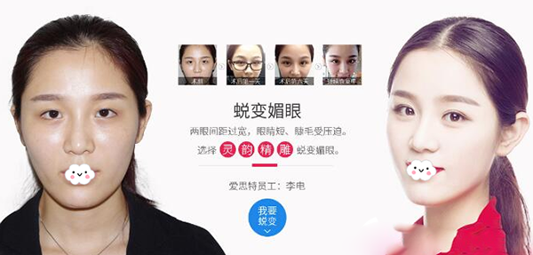 珠海愛思特靈韻大眼術(shù)案例